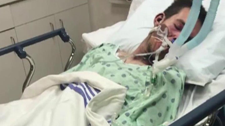 Florida man in coma after e-cig explodes in his face