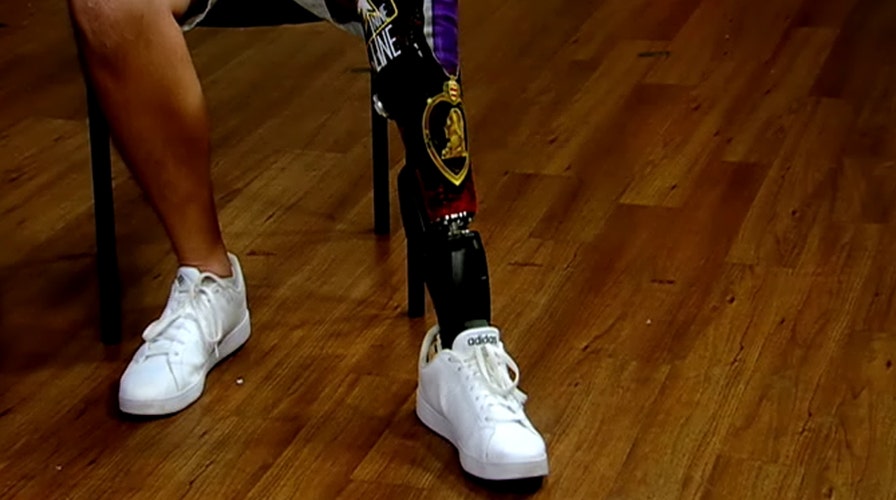Can robotics make prosthetics easier to live with?