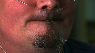 Man wakes up from dentist visit with no teeth left - Fox News