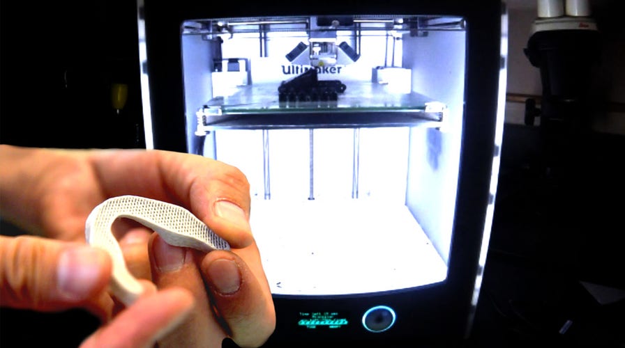 The pursuit of 3D printed organs