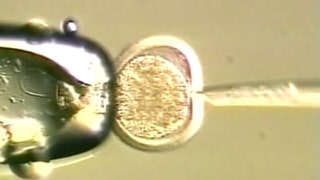 New hope for burn victims? - Fox News