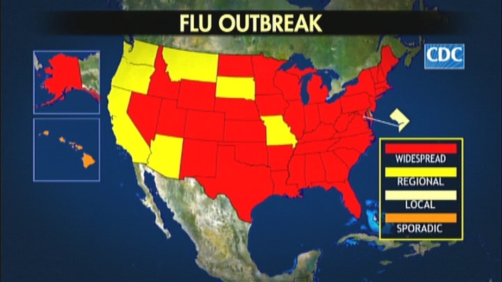 Experts Warn of Strongest Flu in Decade