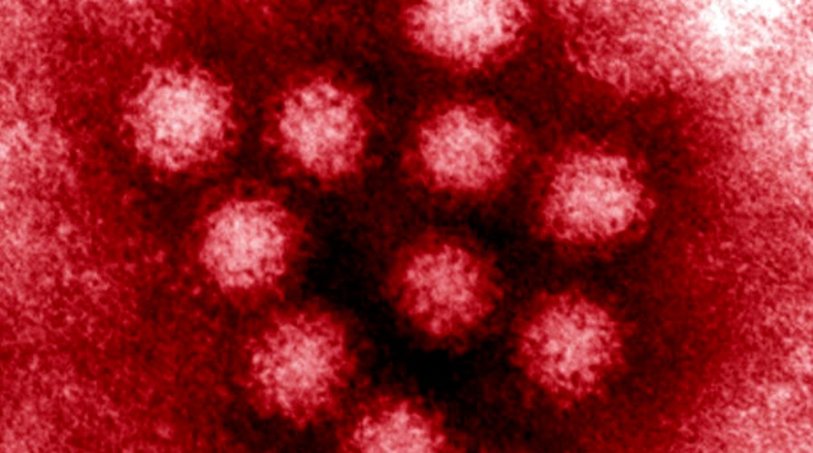 CDC: New norovirus bug sweeping nation