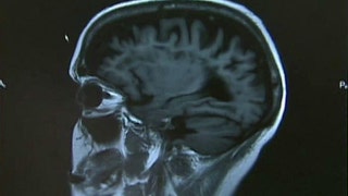 Thickness of brain matter linked to intelligence? - Fox News