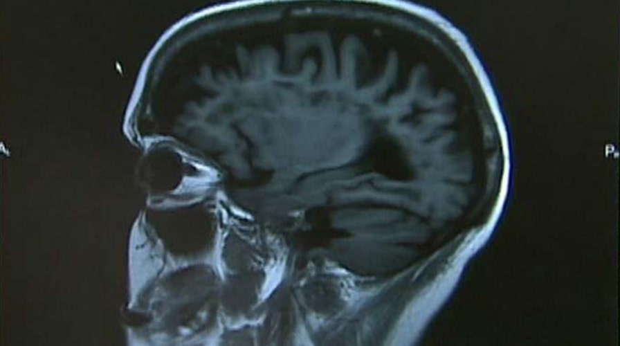 Thickness of brain matter linked to intelligence?