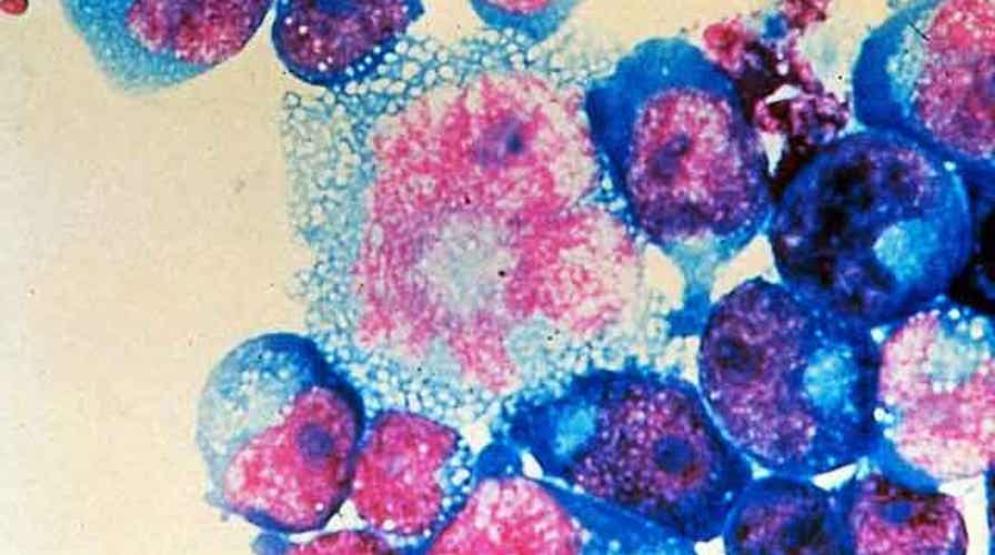 Impact of baby seemingly cured of HIV