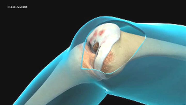 What happens during a total knee replacement?