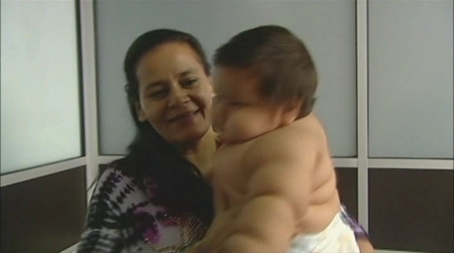 Formula Overdose? Extremely Fat Baby Put On Strict Diet