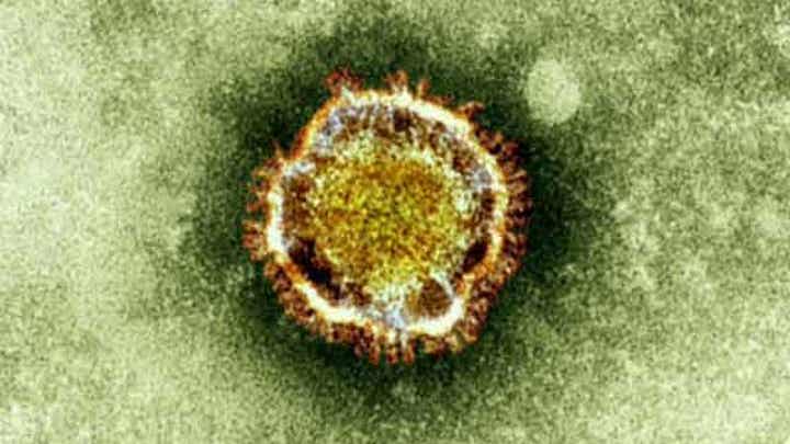 Warning issued over new SARS-like virus