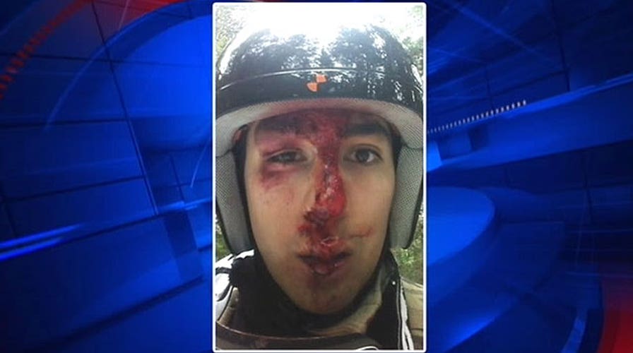 Day on the slopes turns into nightmare