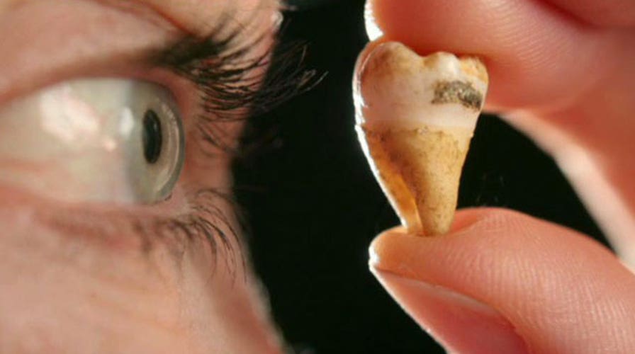 Dentist to use John Lennon's tooth to clone baby