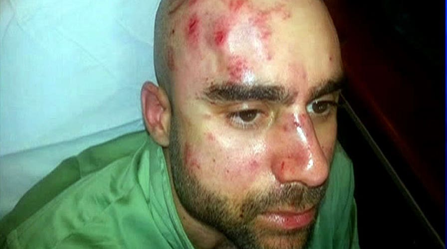 Professor brutally attacked on college campus