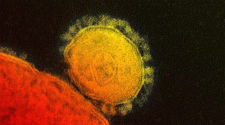 CDC reports first case of MERS caught by contagion