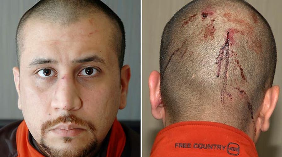 Medical report: The key evidence in Zimmerman trial?