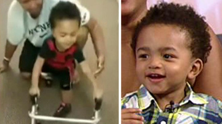 Two-year-old amputee takes first steps in inspiring video