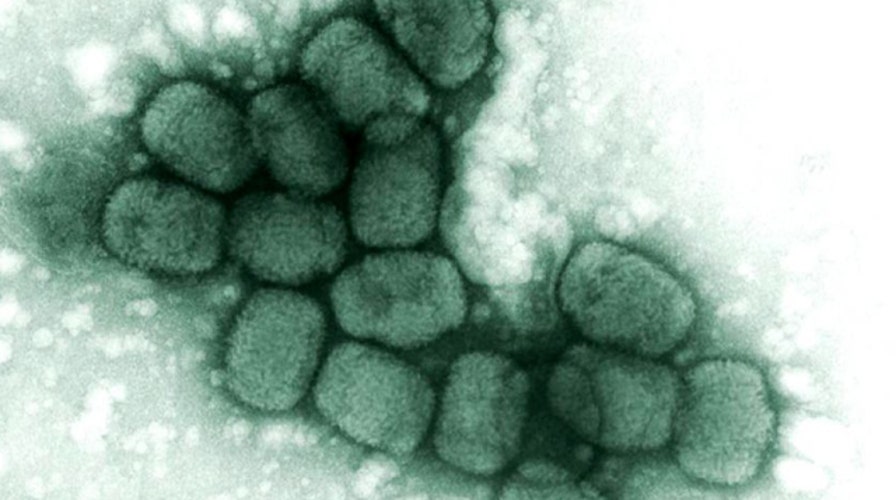 Forgotten vials of smallpox found in gov't storage room