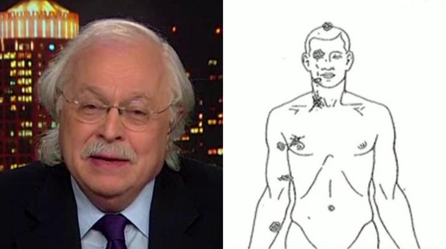 Dr. Michael Baden discusses Michael Brown's autopsy