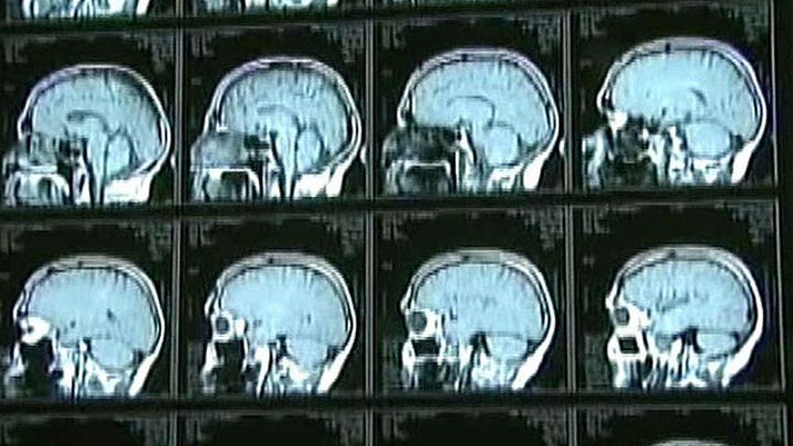 Hospital exposes patients to rare, fatal brain disease?
