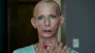 Too graphic? CDC defends anti-smoking ad campaign - Fox News