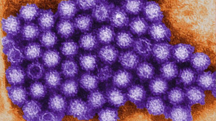 Scientists gaining upper hand in fight against Norovirus?