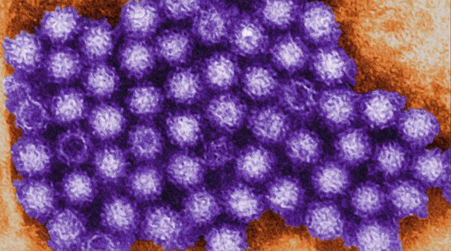 Scientists gaining upper hand in fight against Norovirus?