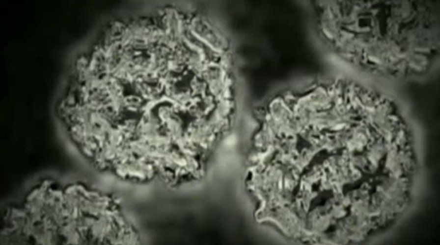 Enterovirus continues to spread across US