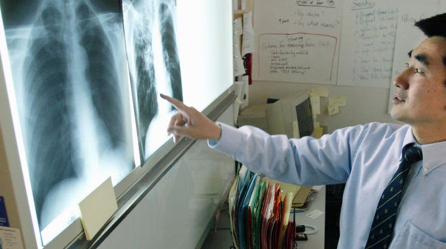 UnitedHealthCare drops Medicare Advantage doctors