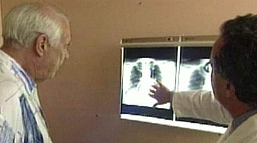 Study: Test can help detect early lung, prostate cancer