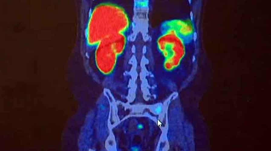 Doctors: Young men should be tested for prostate cancer