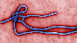 Should Obama be seeking $6.2B to fight Ebola? - Fox News