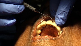 New laser procedure treats gum disease with less pain