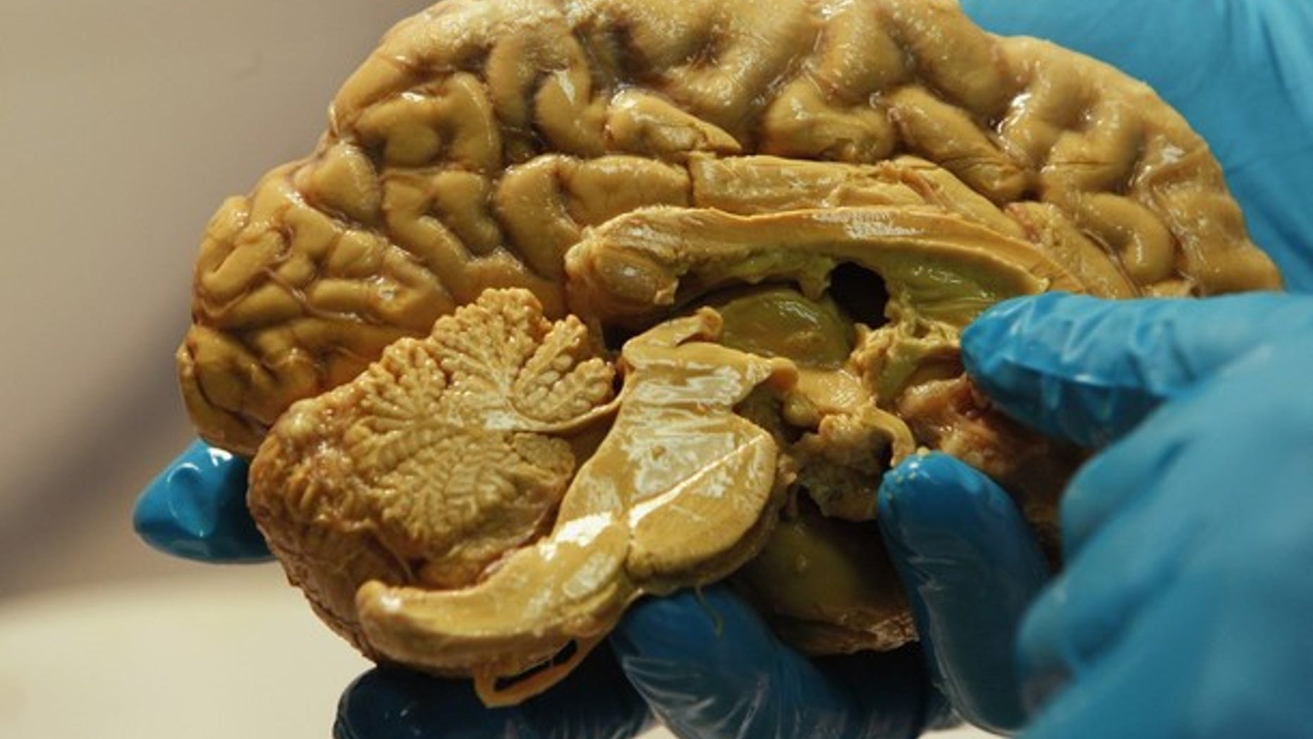 March 16, 2011: Hungarian scientist Tamas Freund holds a human brain at the Institute of Experimental Medicine of Hungarian Academy of Science in Budapest.