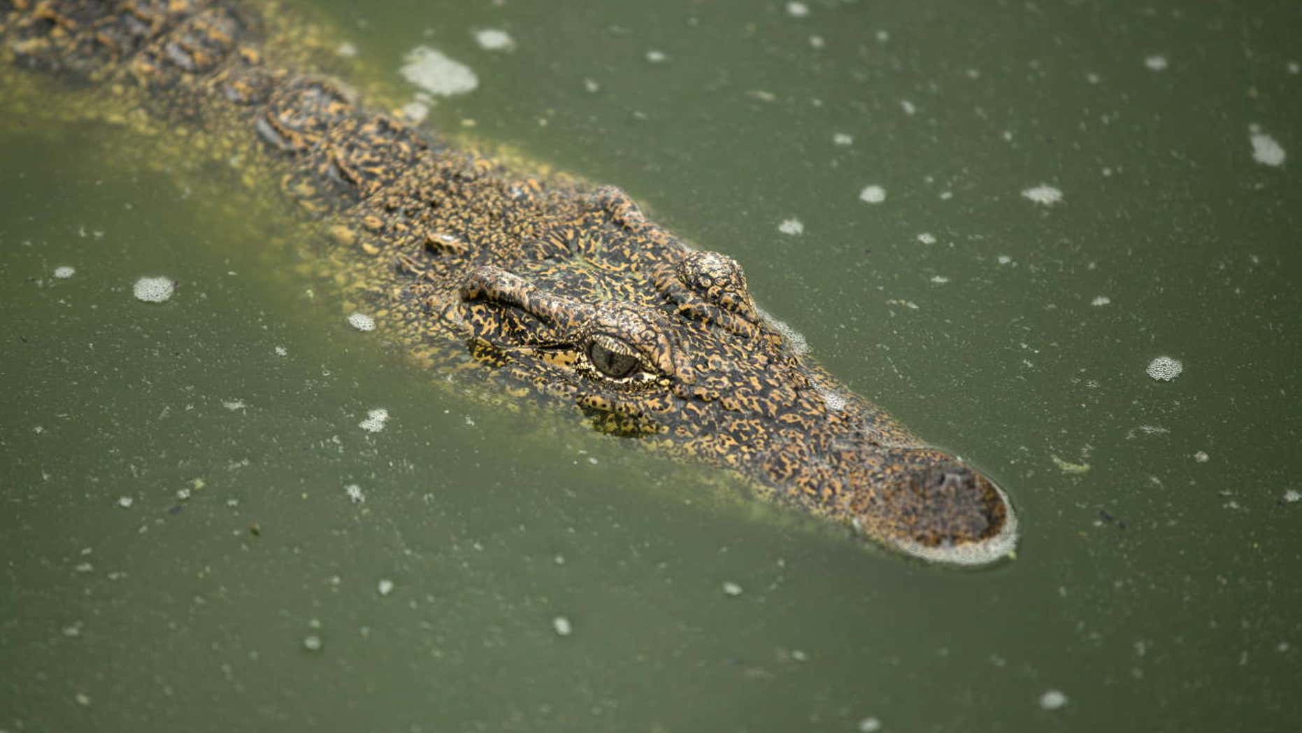 An Australian teen who was attacked by a crocodile after jumping into a crocodile-infested river on a dare was recovering from serious wounds to his arm, officials said Monday