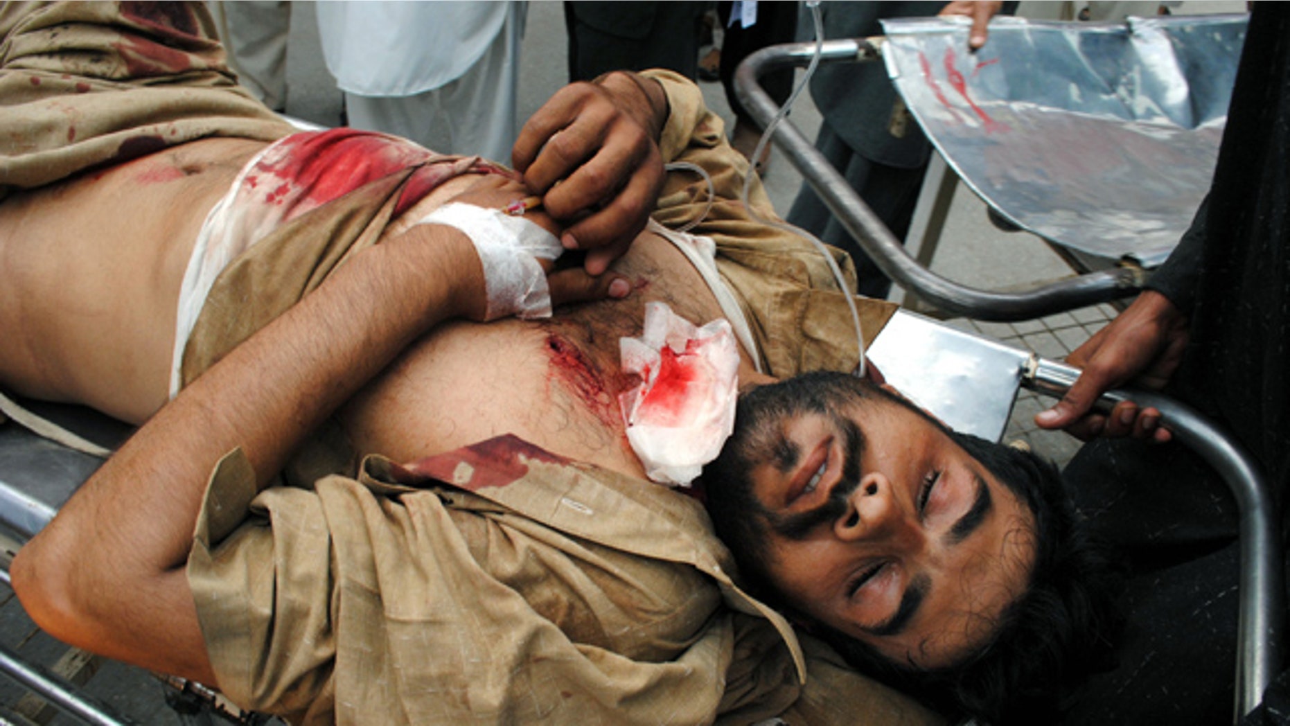 March 31: A person injured by a roadside bombing is rushed to a local hospital in Peshawar, Pakistan.