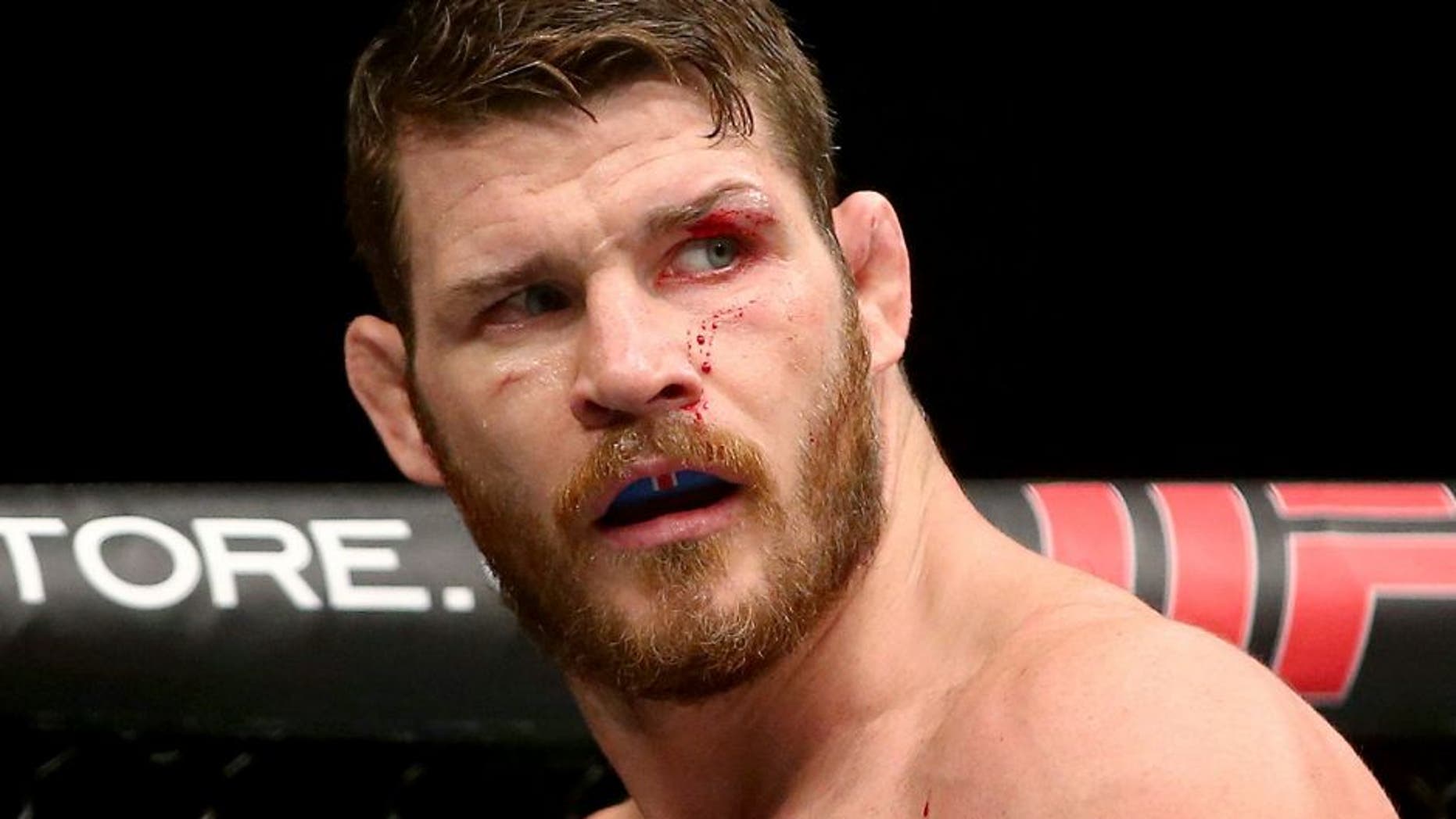SYDNEY, AUSTRALIA - NOVEMBER 08: Michael Bisping of England is seen with a cut over his left eye in his loss to Luke Rockhold in their middleweight fight during the UFC Fight Night 55 event at Allphones Arena on November 8, 2014 in Sydney, Australia. (Photo by Mark Kolbe/Getty Images)