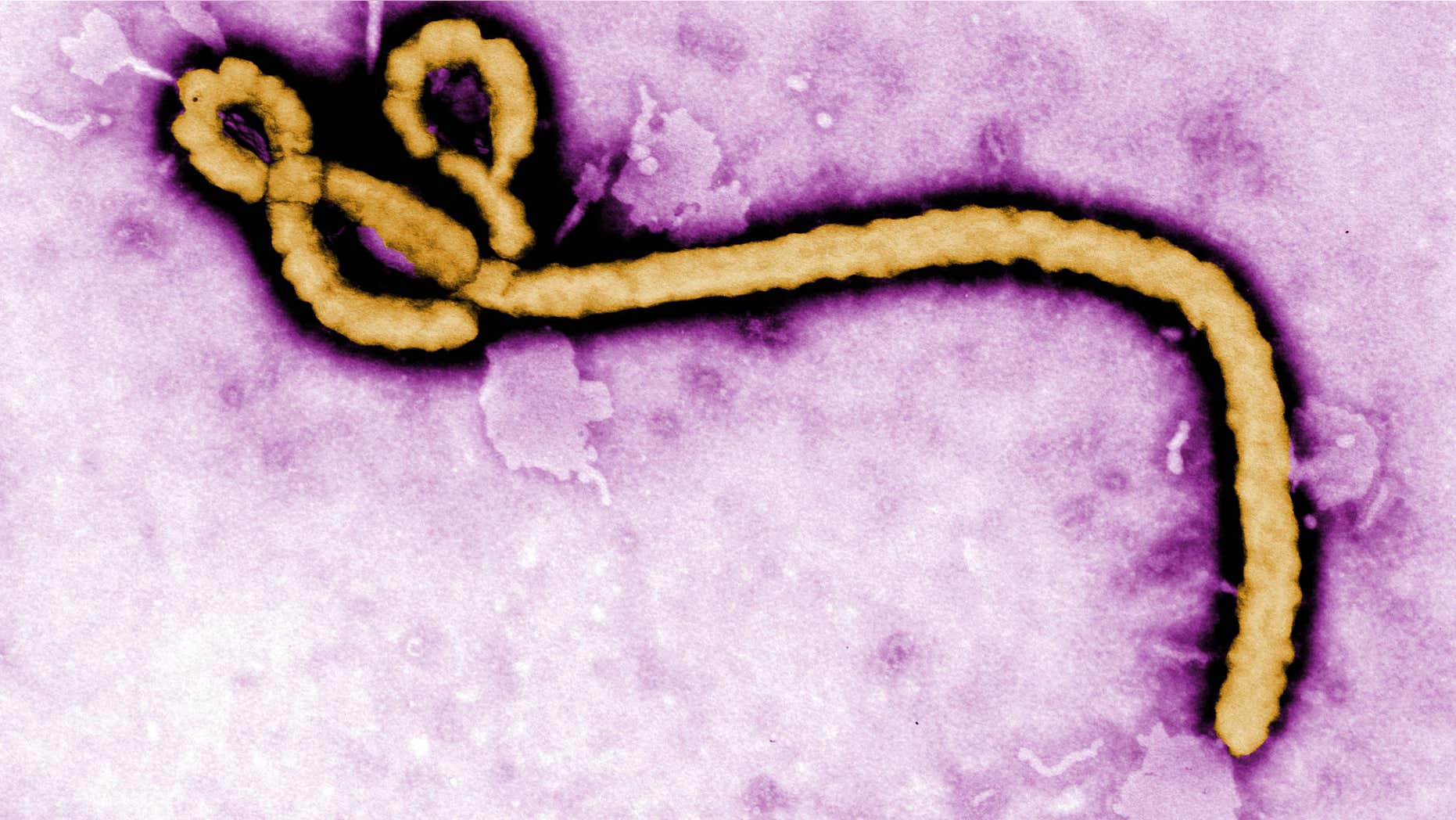 This undated colorized transmission electron micrograph image made available by the CDC shows an Ebola virus virion.