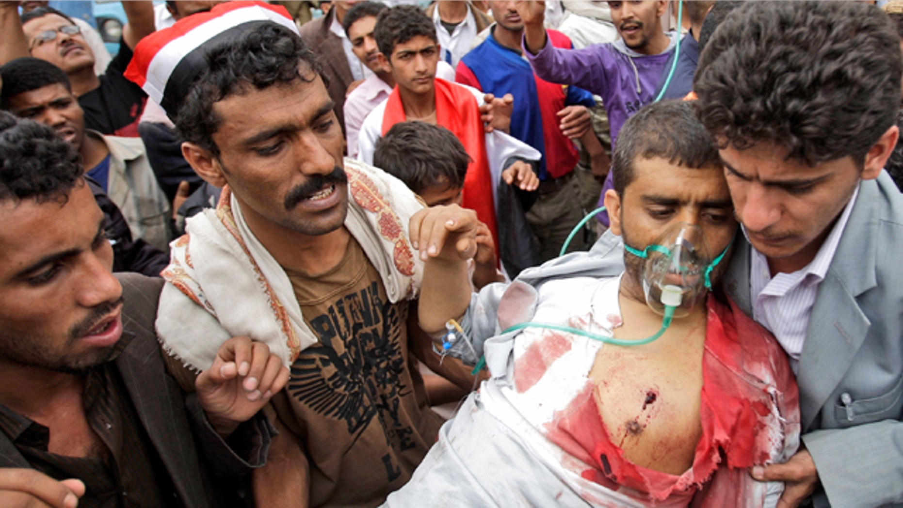 June 1: An injured tribesman loyal to Sheik Sadeq al-Ahmar, the head of the powerful Hashid tribe, is carried to a field hospital, after being wounded in clashes with Yemeni security forces, in Sanaa, Yemen.