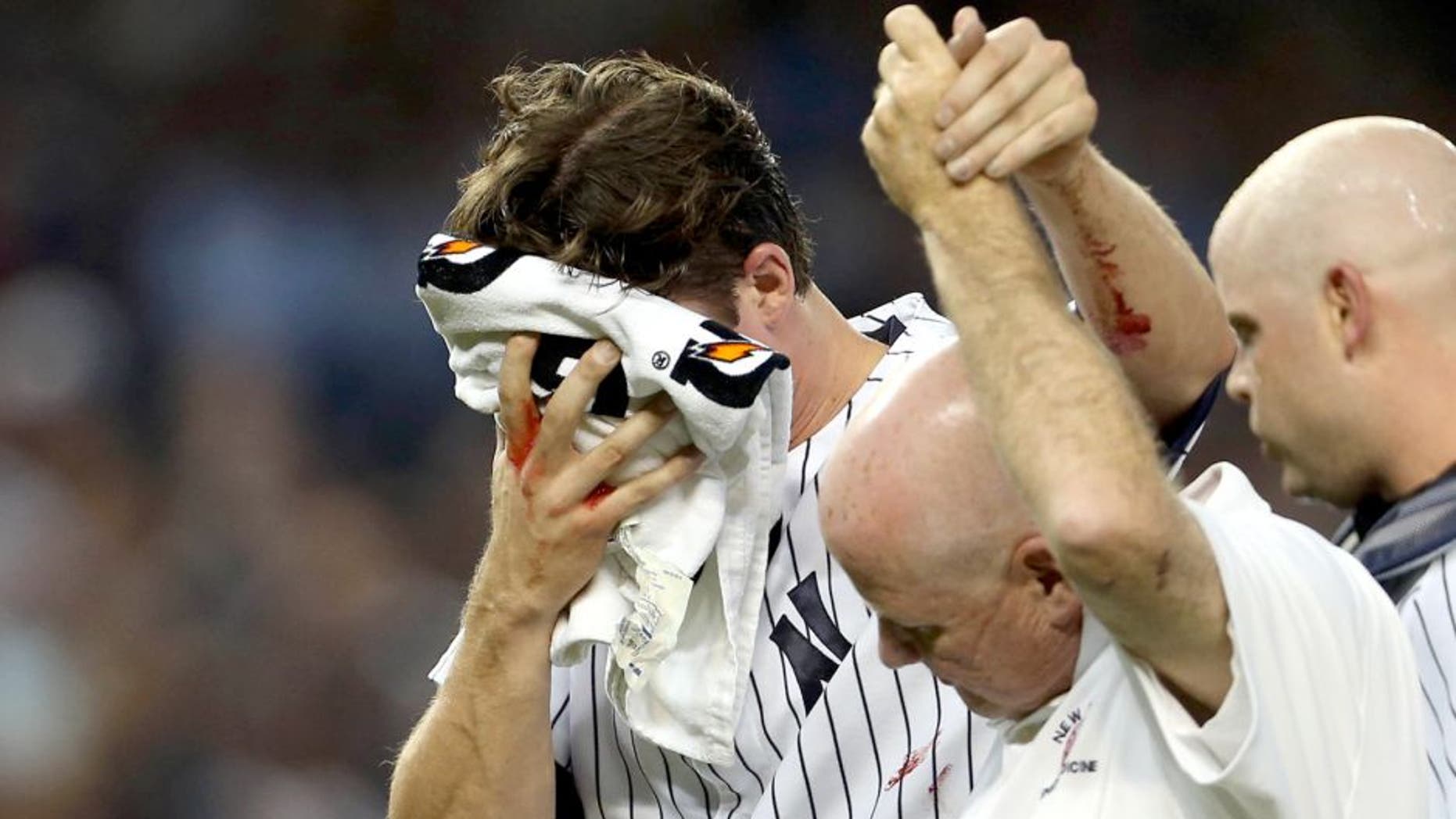 Aug 17, 2015; Bronx, NY, USA; New York Yankees starting pitcher Bryan Mitchell (55) is helped off the field after being hit in the face by a baseball against the Minnesota Twins during the second inning at Yankee Stadium. Mandatory Credit: Adam Hunger-USA TODAY Sports