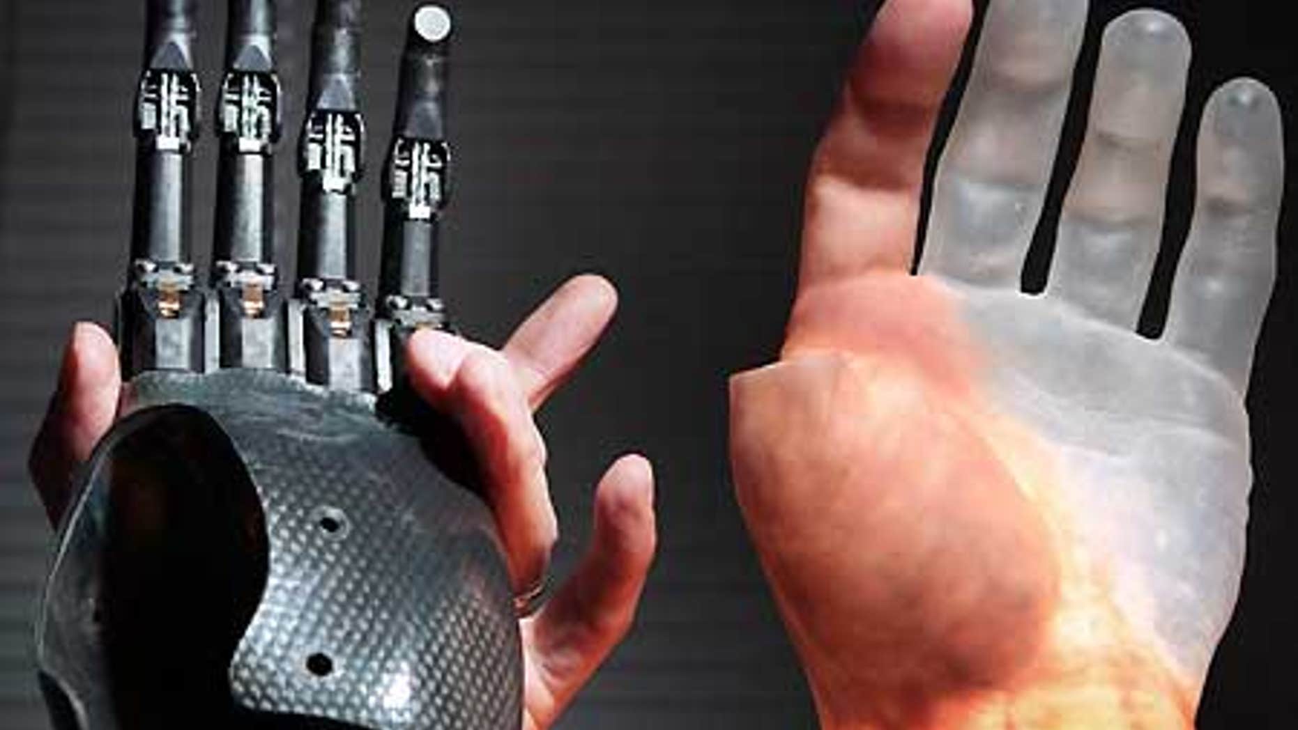 A pianist is is among the first to get Touch Bionics' custom-made fingers, called ProDigits