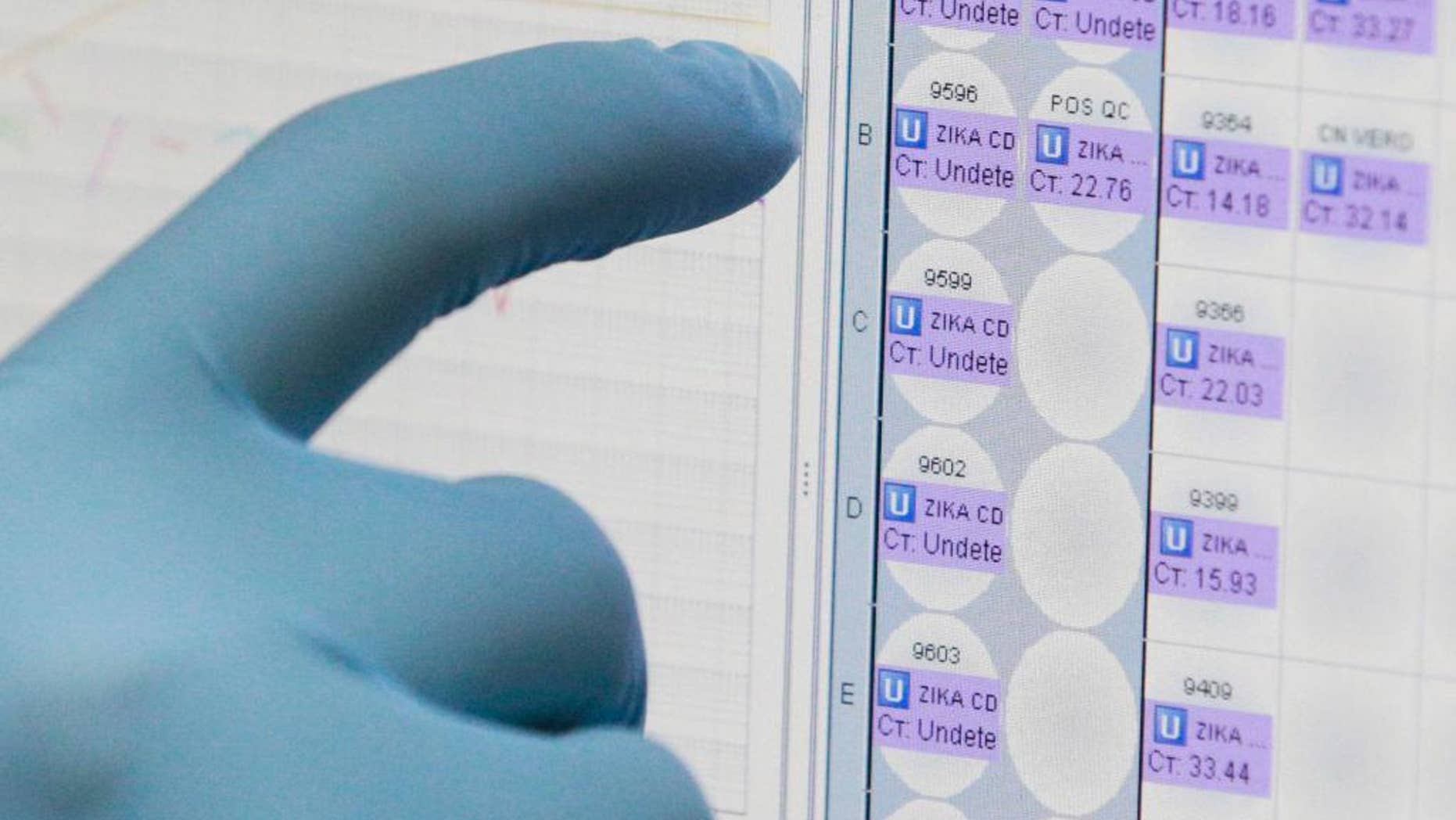FILE - In this Thursday, Feb. 4, 2016 file photo, a medical researcher looks at a monitor for the results of blood tests for various diseases, including Zika, at the Gorgas Memorial laboratory in Panama City. On Tuesday, May 10, 2016, the Centers for Disease Control and Prevention said urine testing is more likely than blood testing to detect Zika virus infection in many patients. (AP Photo/Arnulfo Franco, File)
