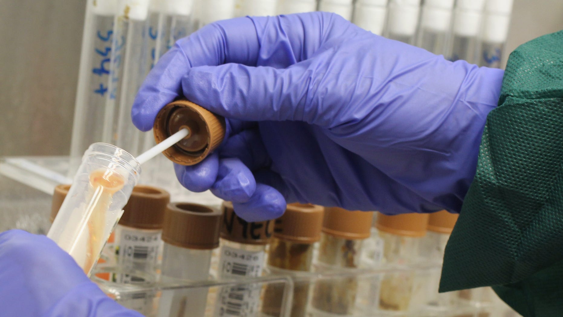 HAMBURG, GERMANY - JUNE 02: A lab technician removes a sample of bloodied stool taken from a patient in order to prepare a bacteria culture to check for enterohemorrhagic E. coli, also known as the EHEC bacteria, at the University Medical Center Hamburg-Eppendorf on June 2, 2011 in Hamburg, Germany. German health authorities are continung to grapple with the current outbreak of EHEC and claim that initial suspicions of cucumbers from Spain as being the source are unfounded, though they warn against consuming raw vegetables. The University Medical Center has the highest number of patients infected with EHEC as well as 102 patients who have come down with hemolytic-uremic syndrome (HUS), a complication that can lead to kidney failure, convulsions and epileptic seizures and is caused by EHEC. Authorites are reporting at least 2,000 cases of EHEC infection nationwide and at least 470 cases of HUS. Across Europe at least 17 people have died from the outbreak. (Photo by Sean Gallup/Getty Images)