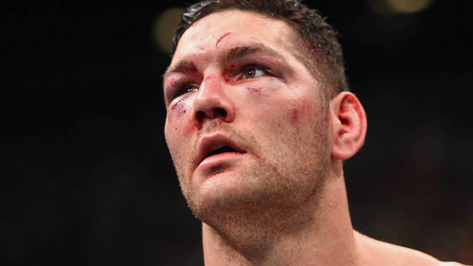 LAS VEGAS, NV - DECEMBER 12: Chris Weidman reacts to his loss to Luke Rockhold in their UFC middleweight championship bout during the UFC 194 event inside MGM Grand Garden Arena on December 12, 2015 in Las Vegas, Nevada. (Photo by Josh Hedges/Zuffa LLC/Zuffa LLC via Getty Images)