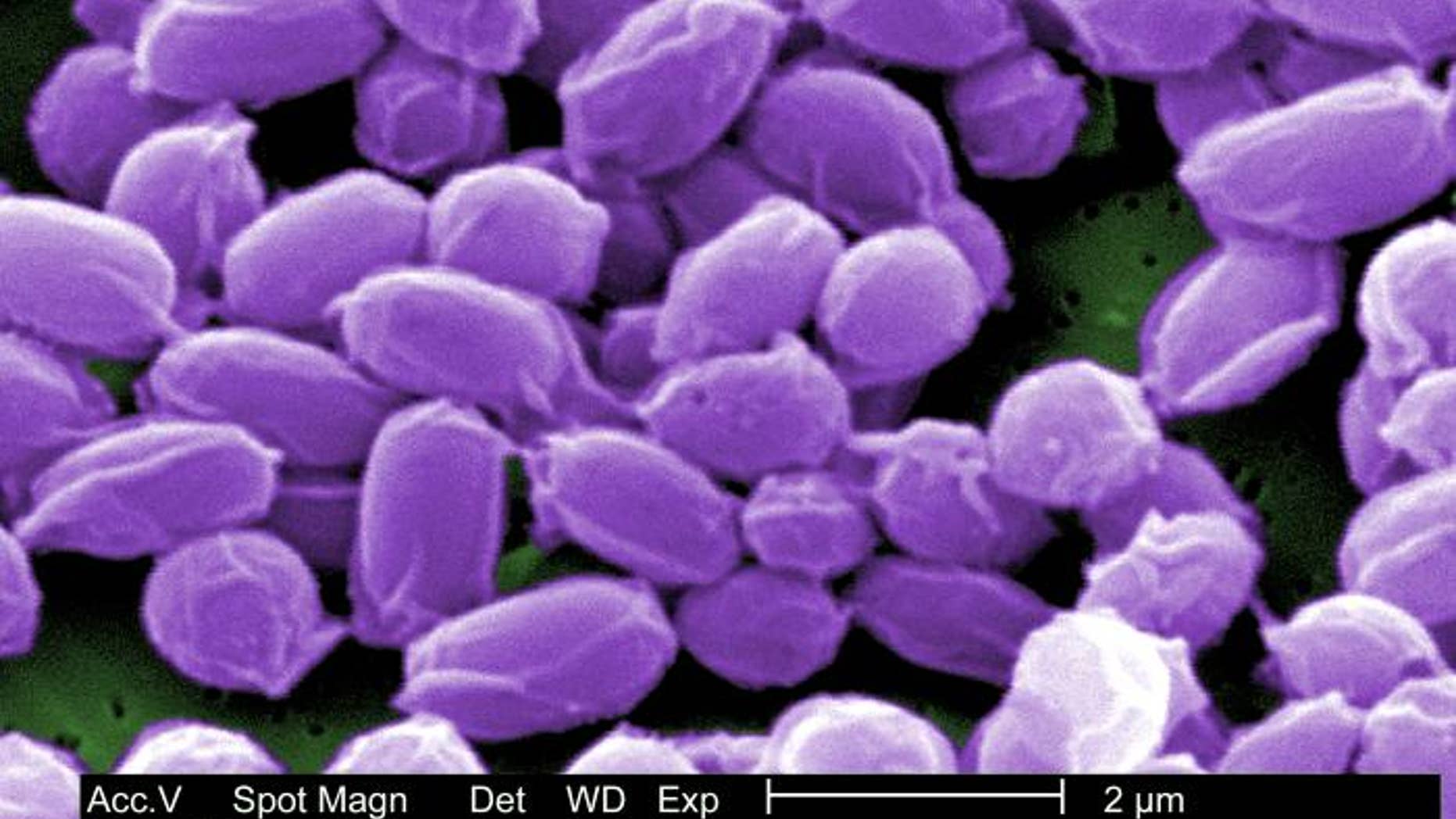 Under a very high magnification, a scanning electron micrograph captures spores of anthrax bacteria. These spores can live for many years, which enables the bacteria to survive in a dormant state.