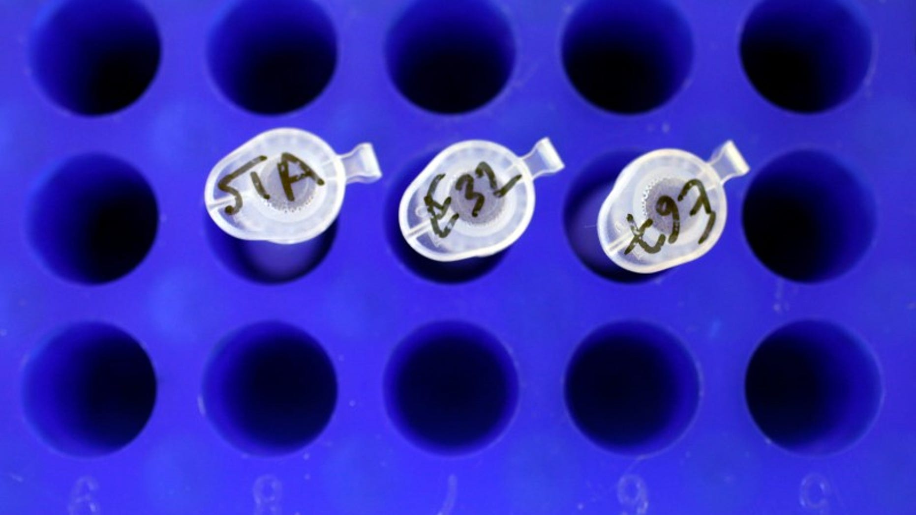 Test tubes filled with samples of bacteria to be tested are seen at the Health Protection Agency in north London in this file photo dated March 9, 2011. REUTERS/Suzanne Plunkett