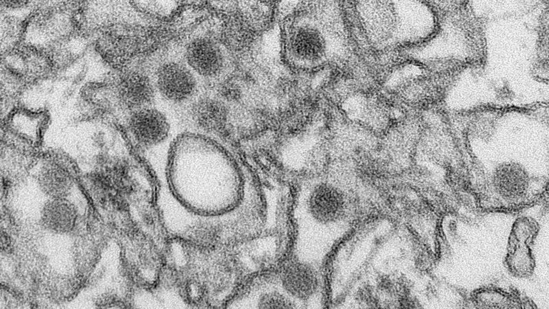 A transmission electron micrograph (TEM) shows the Zika virus, in an undated photo provided by the Centers For Disease Control in Atlanta, Georgia. REUTERS/CDC/Cynthia Goldsmith/Handout via Reuters