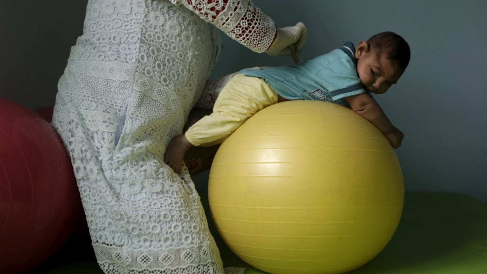 Physiotherapist Leal does exercises with Lucas, 4-months old, who is Miriam Araujo's second child and born with microcephaly in Pedro I hospital in Campina Grande