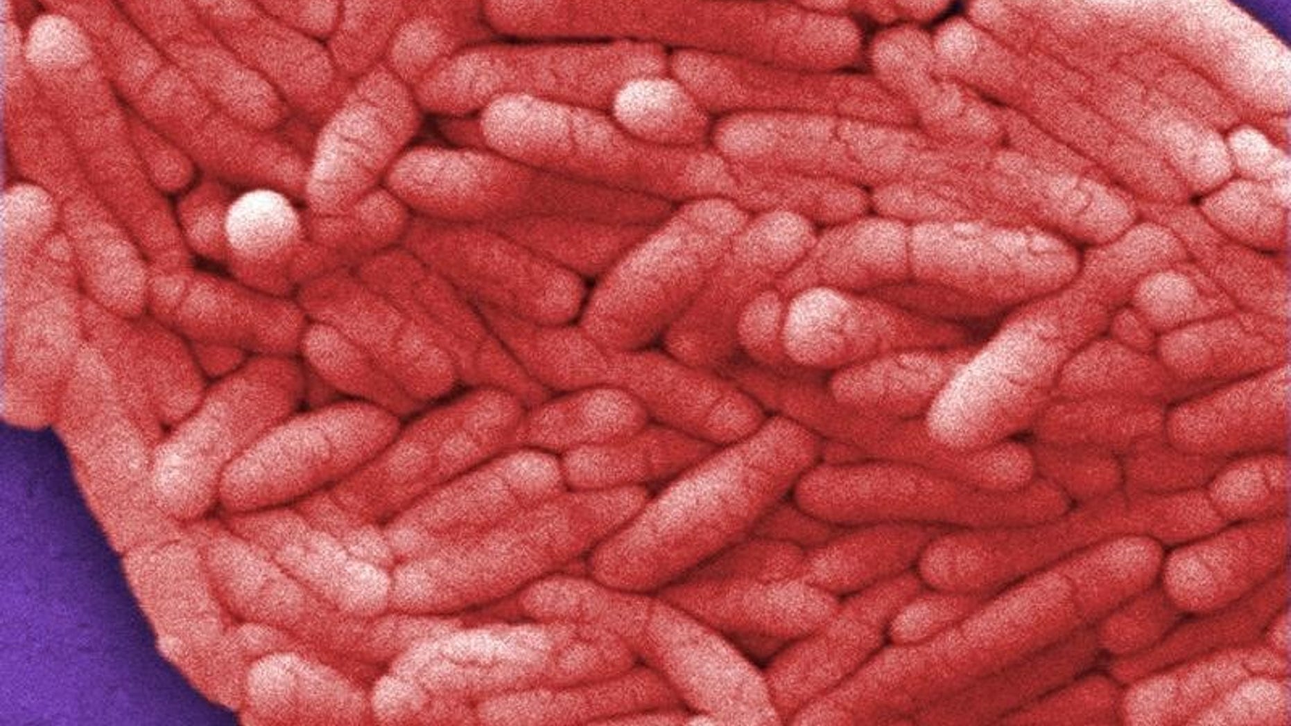 File photo of salmonella bacteria