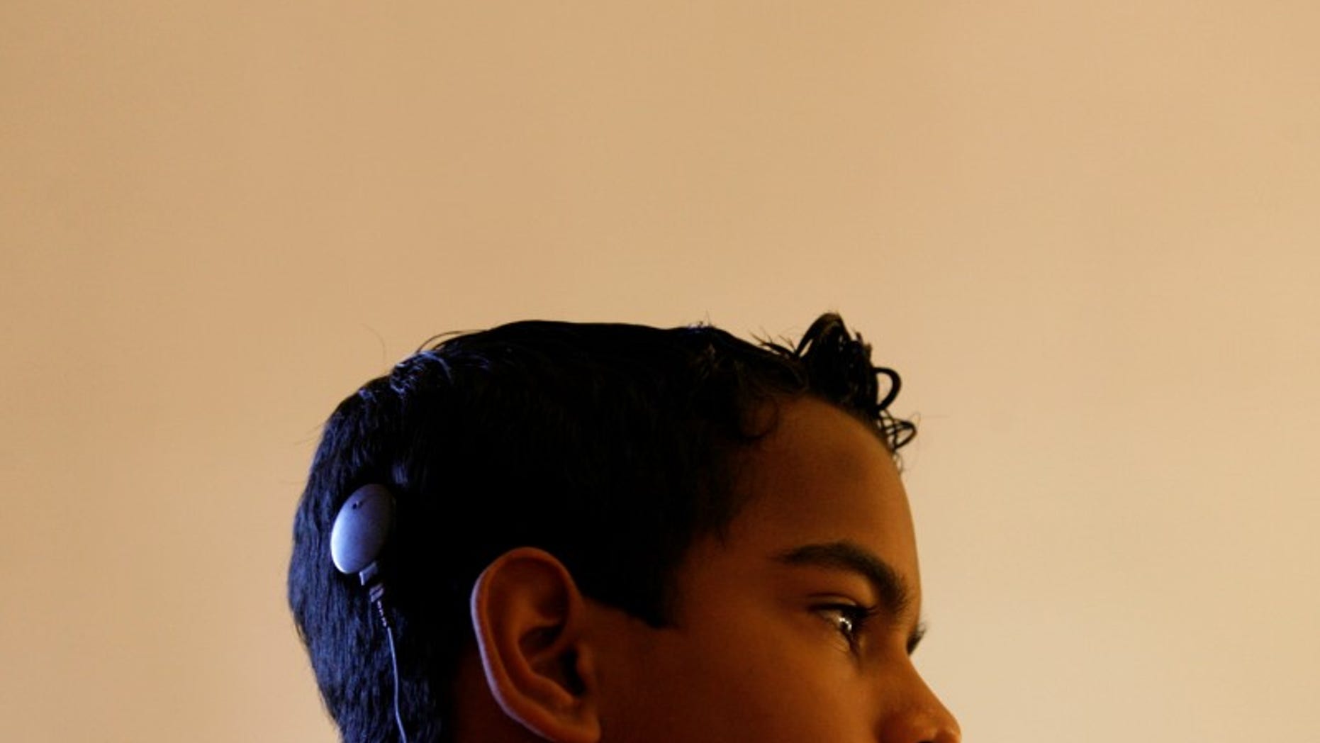 A speech and hearing impaired child with a cochlear implant which he received free of charge attends a therapy session at the Pradera hospital in Havana