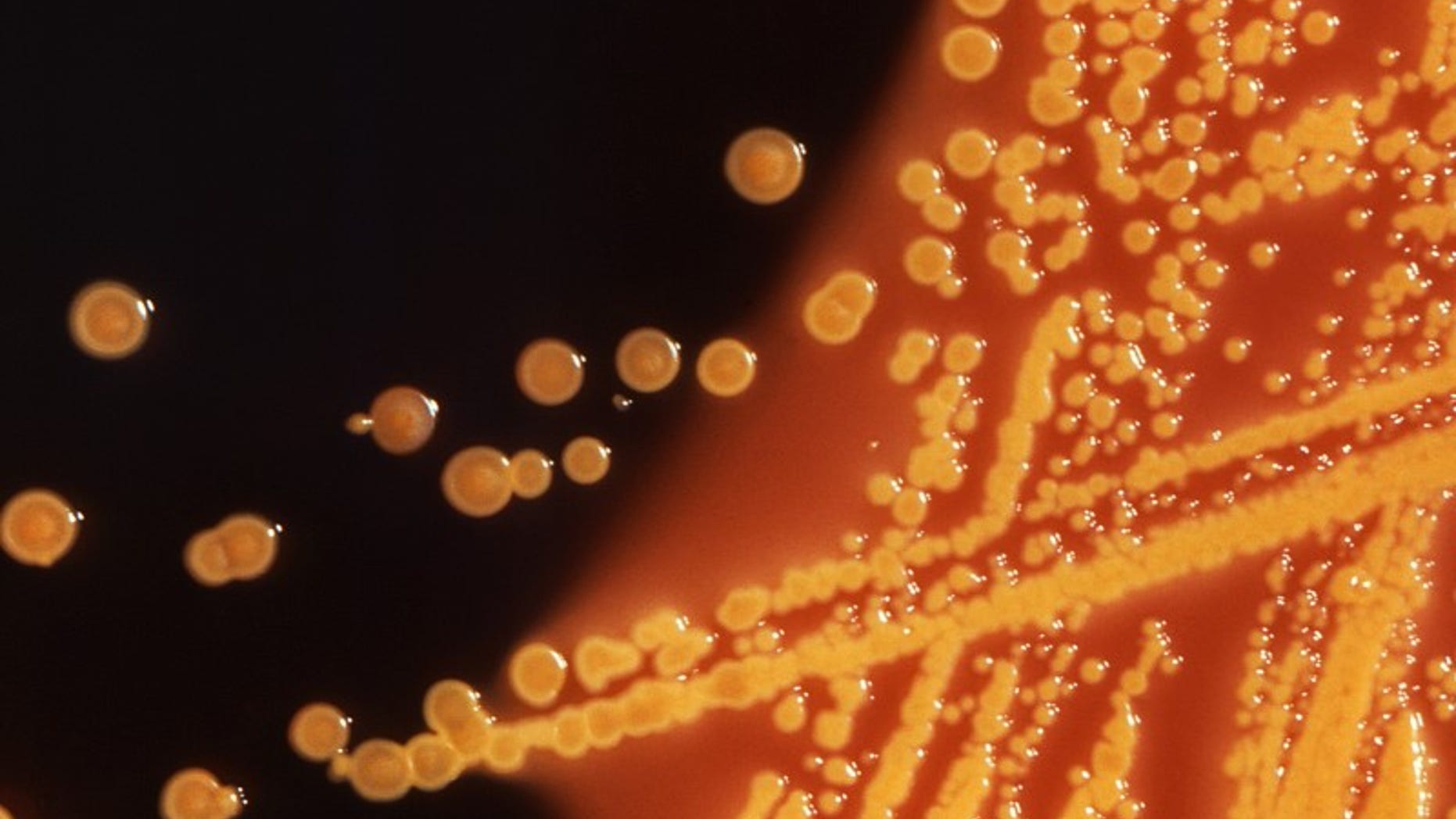 Colonies of E. coli bacteria are seen in a microscopic image courtesy of the CDC