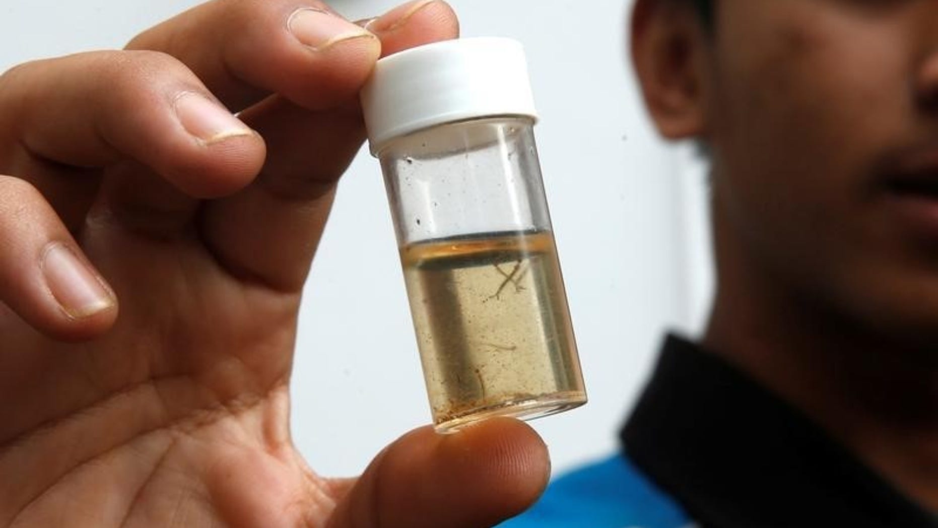 A member of a pest control team shows a container of mosquito larvae that they collected during their inspections at Zika clusters in Singapore